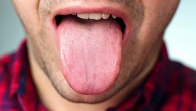 دقت ۹۸ درصدی هوش مصنوعی در تشخیص بیماری‌ها از رنگ زبان